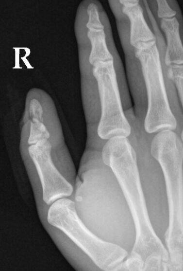 hand.jpg